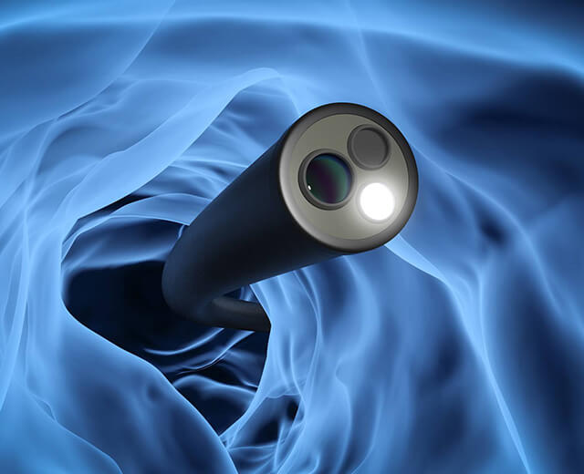 胃カメラとの同日検査が可能