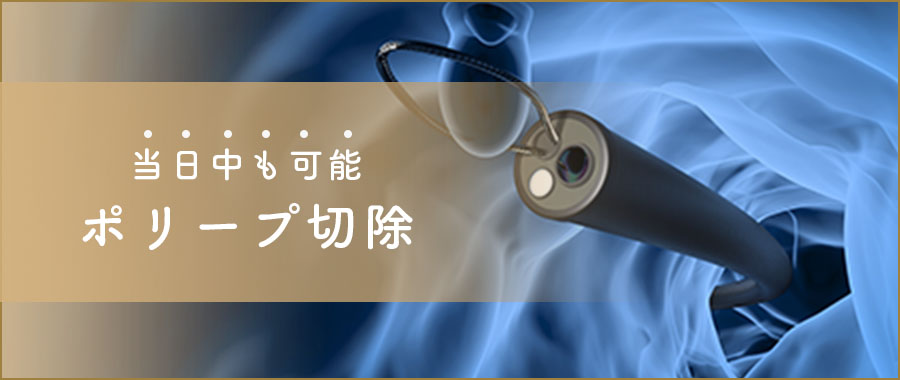 当日中のポリープ切除も可能