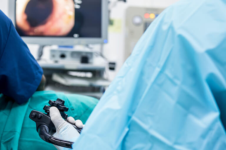 胃カメラ検査＋大腸カメラ検査